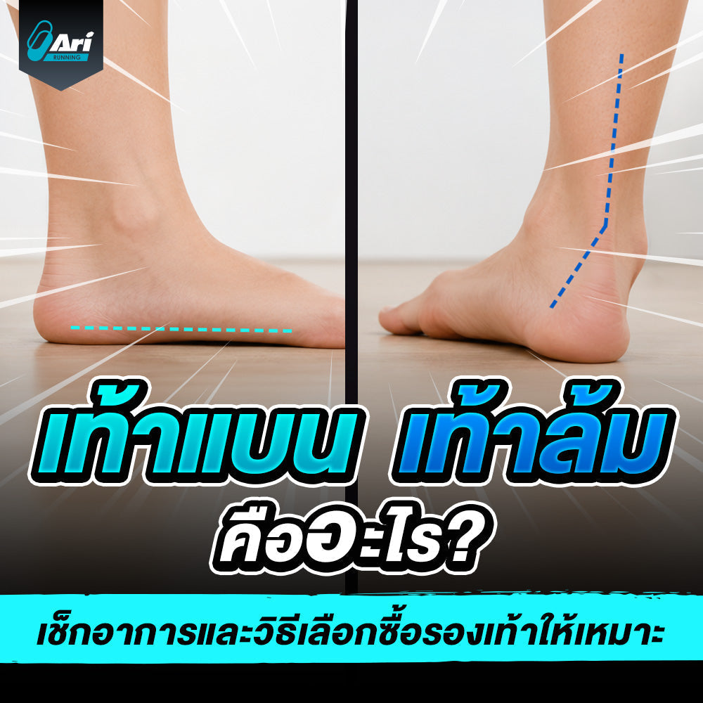 เท้าล้มคืออะไร สังเกตอาการเท้าแบนและวิธีดูแลก่อนส่งผลต่อการเดิน