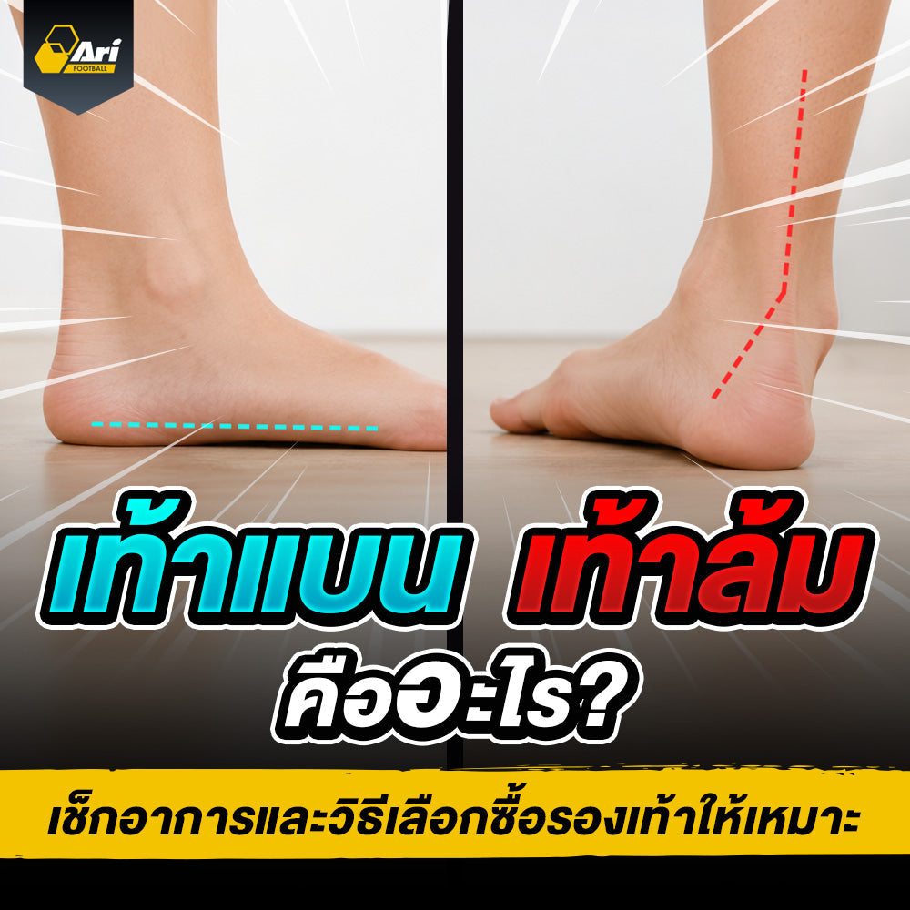 เท้าล้มคืออะไร สังเกตอาการเท้าแบนและวิธีดูแลก่อนส่งผลต่อการเดิน